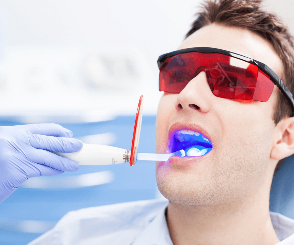 Laser Teeth Cleaning in Dubai Laser Tooth Extraction Bissan Medical