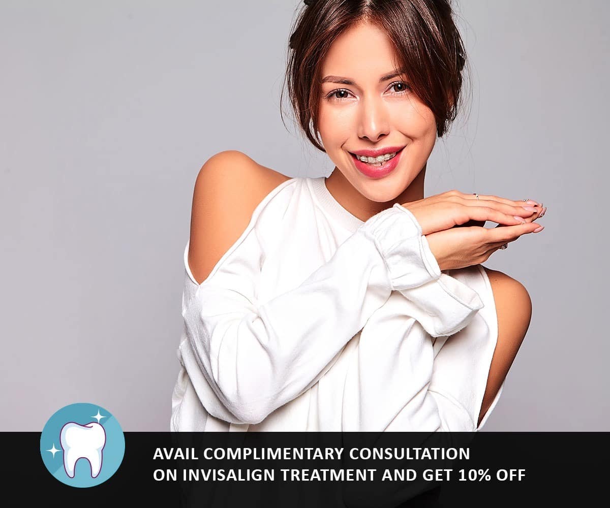 Invisalign