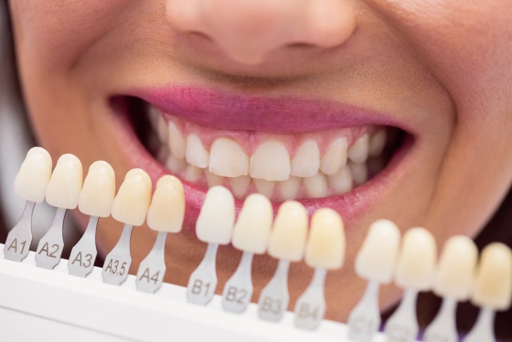 Top Tips for Pearly Whites