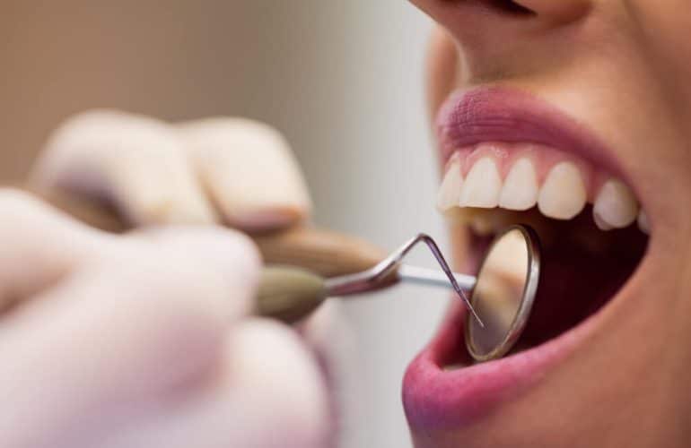 Cosmetic dentistry in Dubai