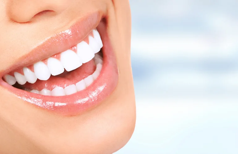 Hollywood Smile Dental Clinic