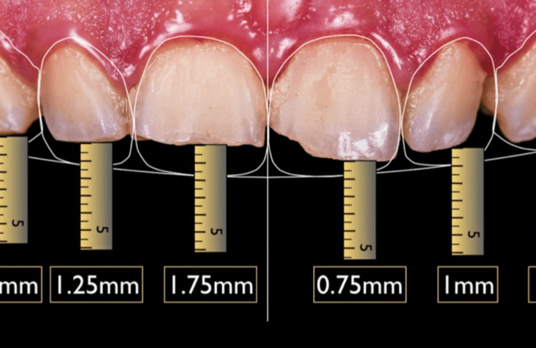 restorative dentistry