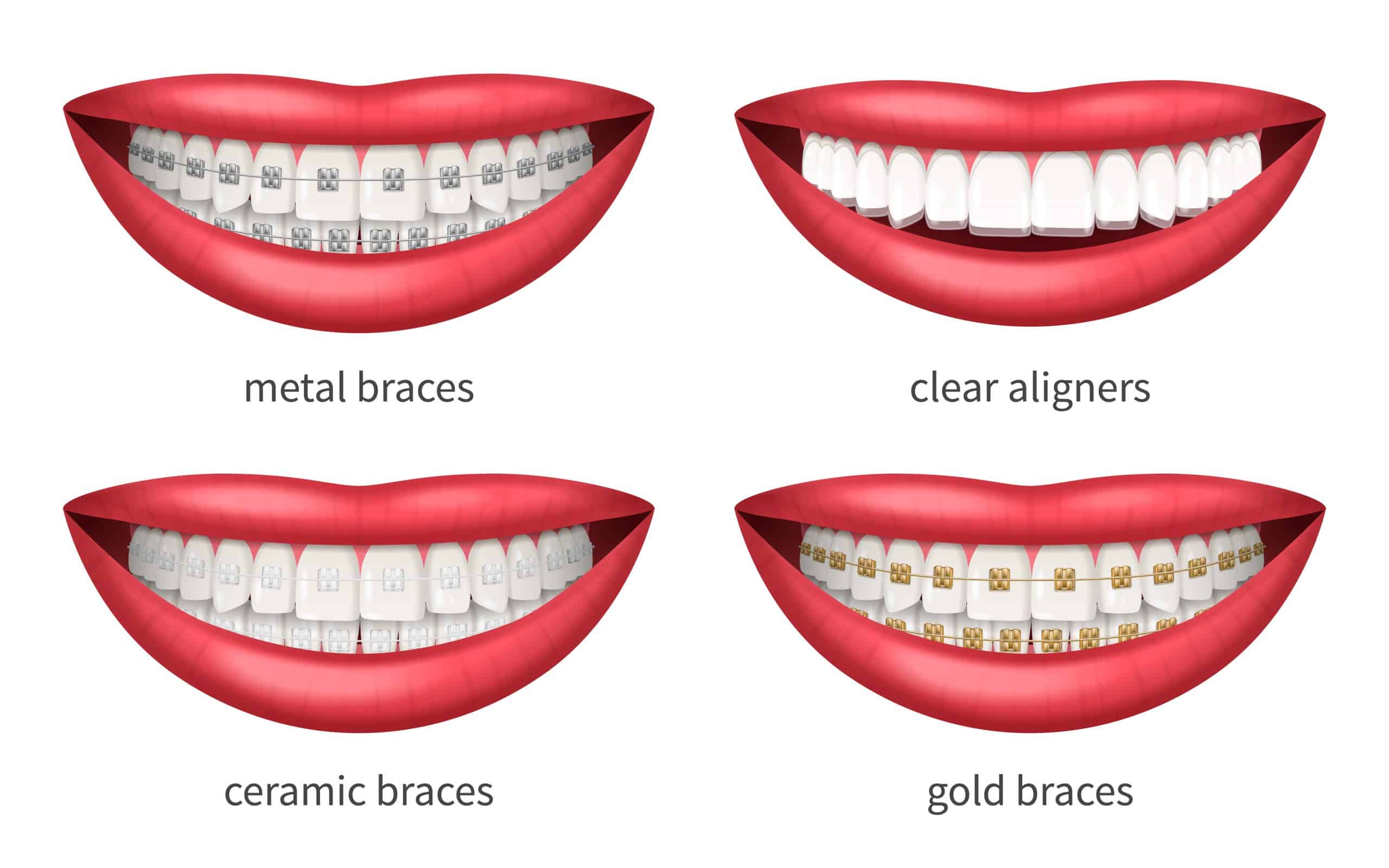 Orthodontic treatment in Dubai