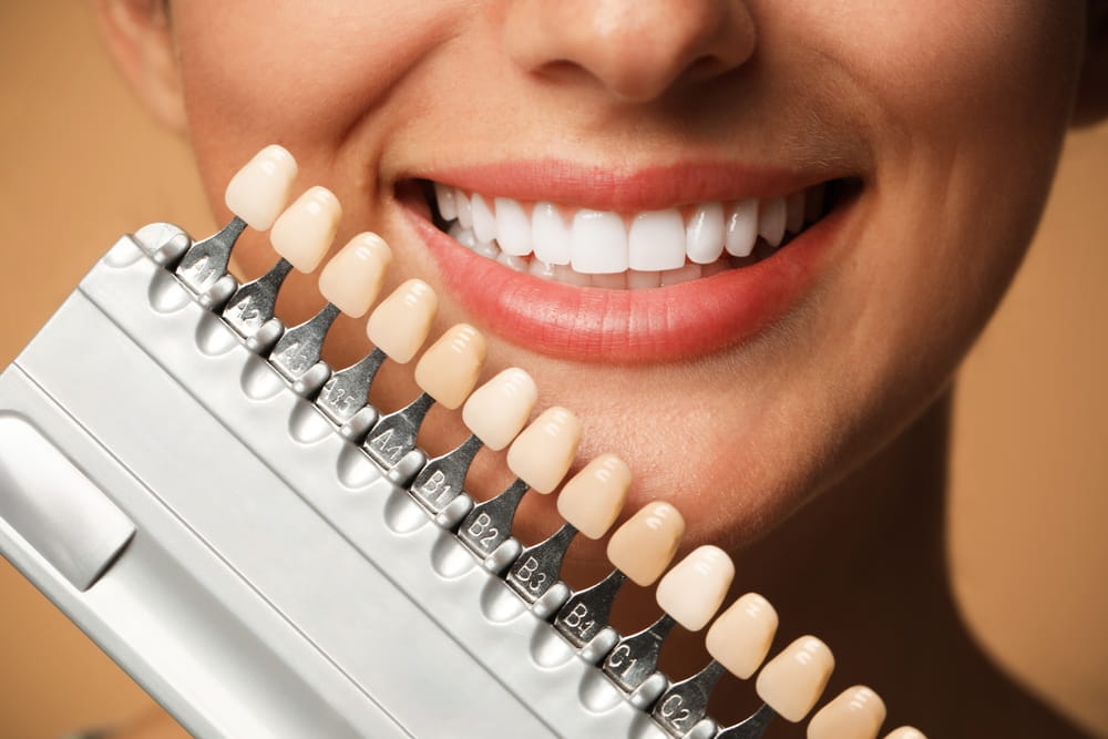 veneers cost Dubai